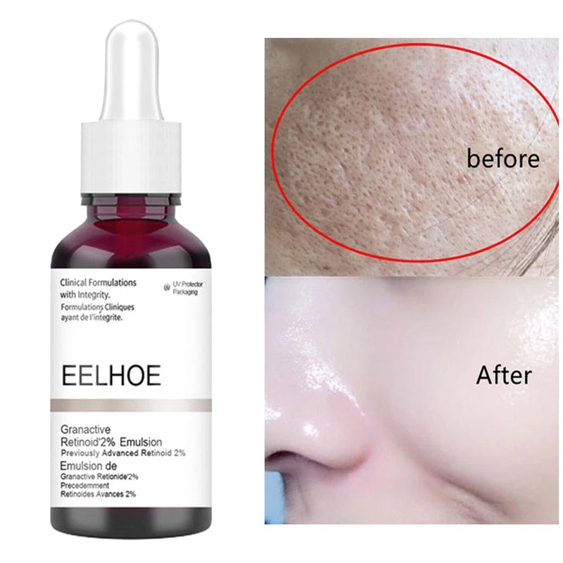 Salicylic Acid Essence - Skin Care Solution